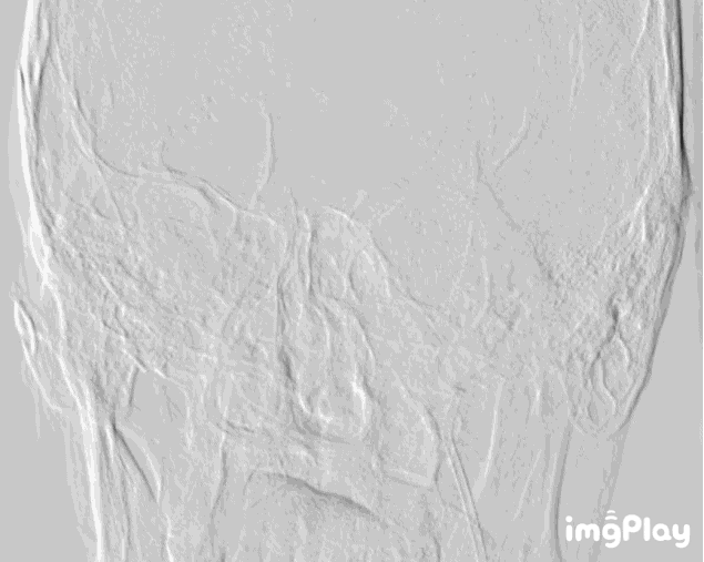 2.GIF