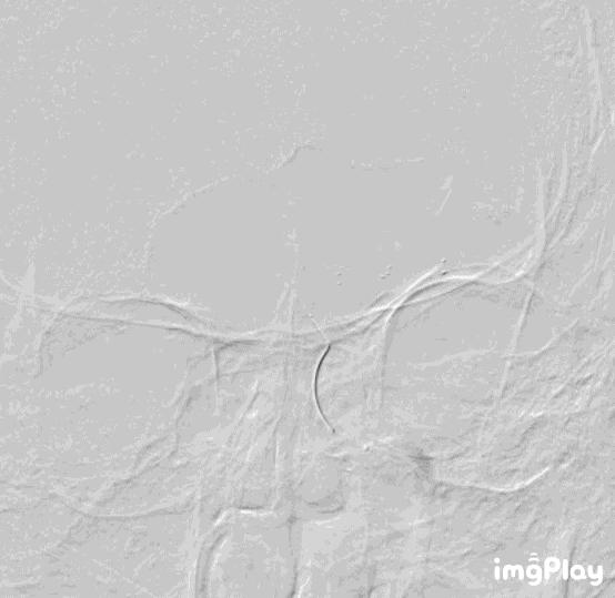 4.GIF